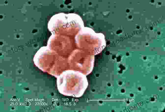 Acinetobacter Under A Microscope Multiple Sclerosis Mad Cow Disease And Acinetobacter