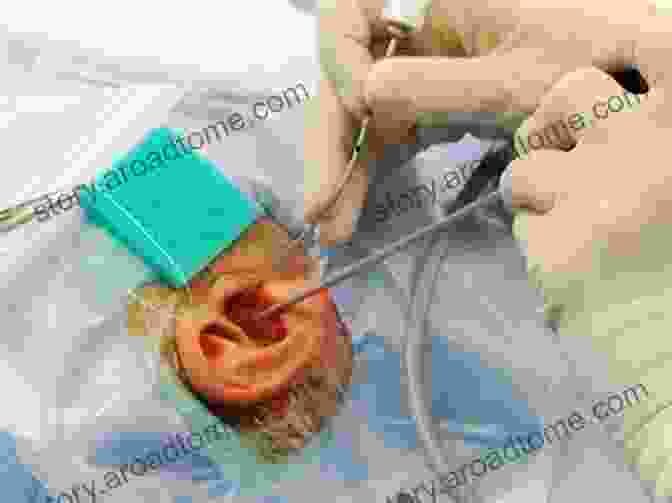 Endoscope Indicating An Area Of The Ear During Surgery Endoscopic Ear Surgery: Principles Indications And Techniques