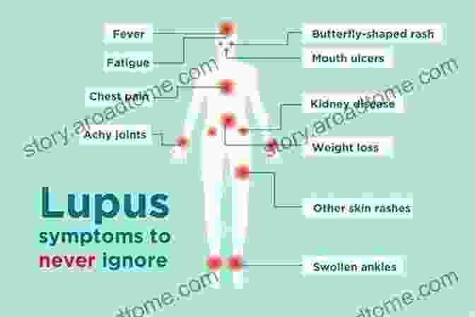 Lupus Butterfly Rash Lupus And The Immune System: Natural Remedies