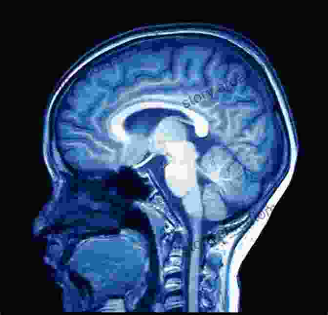 Magnetic Resonance Imaging (MRI) Scan Of The Neck And Brain Image Principles Neck And The Brain (Magnetic Resonance Imaging Handbook)