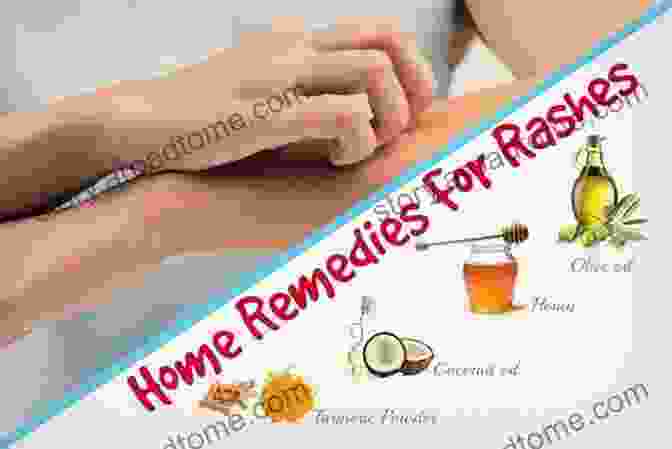 Woman Applying Homeopathic Remedy To Her Skin Rash Dermatitis Skin Rash Naturally Treated With Homeopathy And Schuessler Salts (homeopathic Tissue Salts): A Homeopathic And Naturopathic Guide