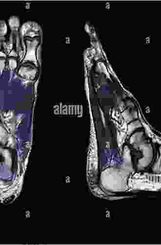 Diagnostic Imaging of the Foot and Ankle