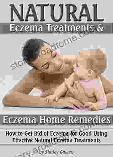 Natural Eczema Treatments And Eczema Home Remedies: How To Get Rid Of Eczema For Good Using Effective Natural Eczema Treatments (Natural Remedies For Eczema)