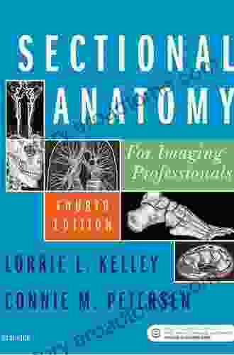 Sectional Anatomy For Imaging Professionals E