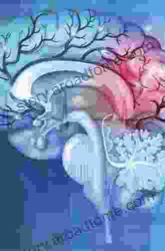 Seizures in Cerebrovascular Disorders: A Clinical Guide